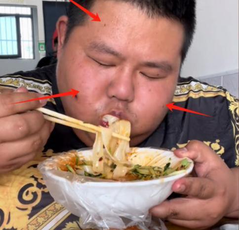 河北校草三年吃成410斤睡塌三床长黑九游娱乐斑靠吃播年入300万引热议(图8)